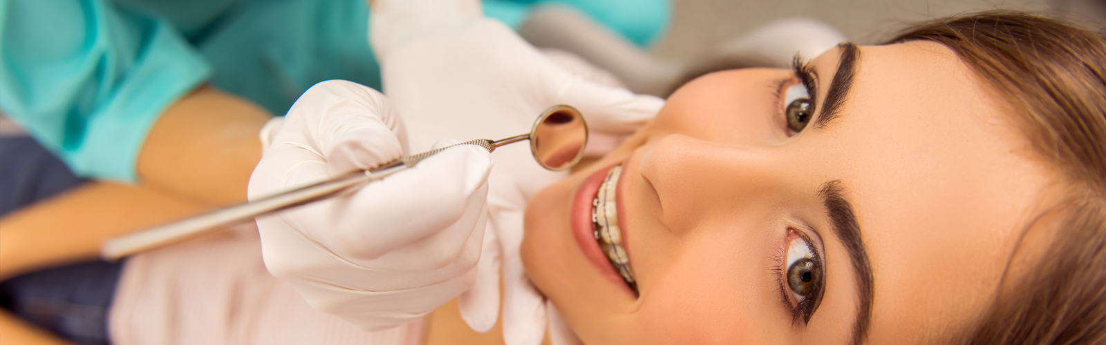 Important Things to Know Before You Get Dental Braces