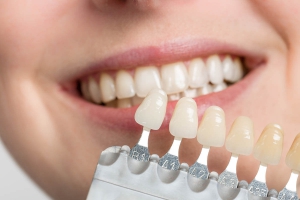 What is the difference between veneers, crowns, and implants?