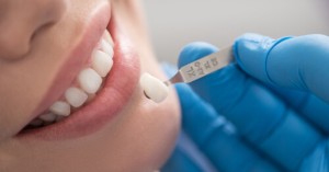 Orthodontics